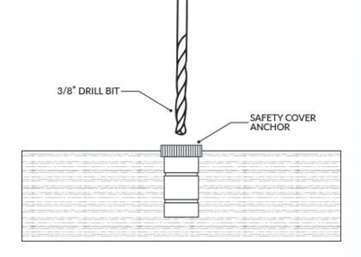 b2ap3 amp Step1 Anchor Puller